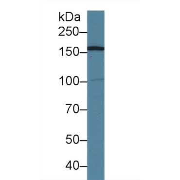 Absent In Melanoma 1 (AIM1) Human Polyclonal Antibody
