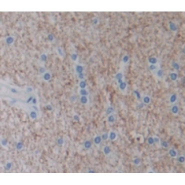 Nephroblastoma Overexpressed Gene (NOV) Human Polyclonal Antibody