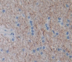 Nephroblastoma Overexpressed Gene (NOV) Human Polyclonal Antibody