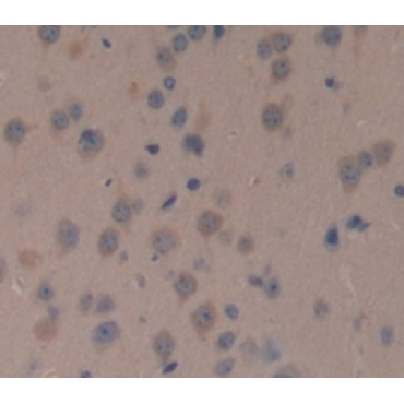 Nephroblastoma Overexpressed Gene (NOV) Mouse Polyclonal Antibody
