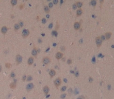 Nephroblastoma Overexpressed Gene (NOV) Mouse Polyclonal Antibody