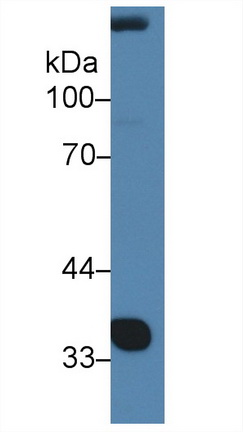 Nephroblastoma Overexpressed Gene (NOV) Rat Polyclonal Antibody