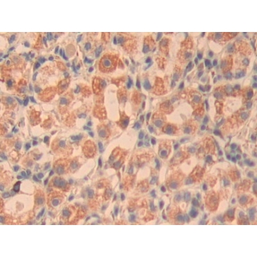 Cysteine Rich Protein, Angiogenic Inducer 61 (CYR61) Human Polyclonal Antibody