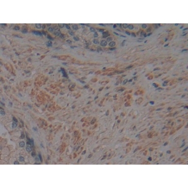 Corin (CRN) Human Polyclonal Antibody