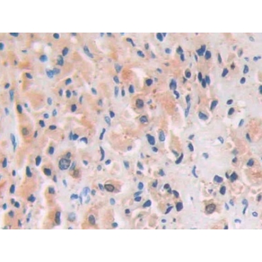 Channel Activating Protease 1 (CAP1) Human Polyclonal Antibody