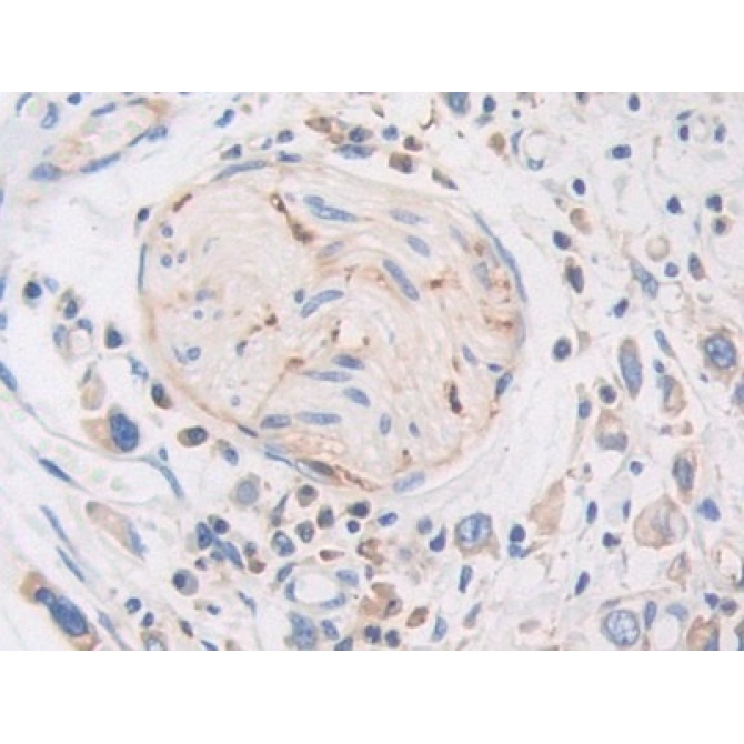 Pregnancy Zone Protein (PZP) Human Polyclonal Antibody