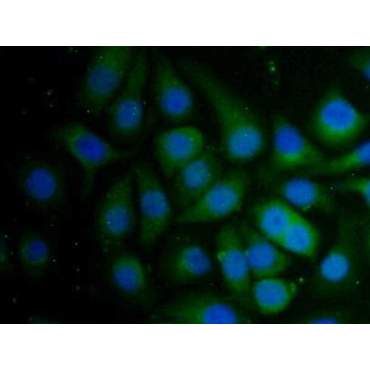Pregnancy Zone Protein (PZP) Mouse Polyclonal Antibody
