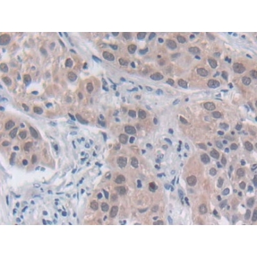 Sex Determining Region Y (SRY) Human Polyclonal Antibody