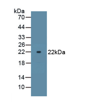 ATPase, Na+/K+ Transporting Alpha 1 Polypeptide (ATP1a1) Human, Mouse, Rat Polyclonal Antibody