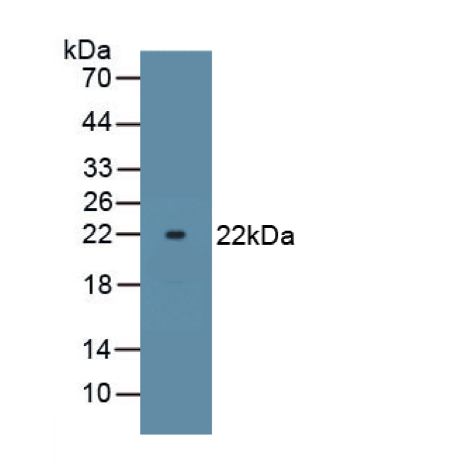 ATPase, Na+/K+ Transporting Alpha 1 Polypeptide (ATP1a1) Human, Mouse, Rat Polyclonal Antibody
