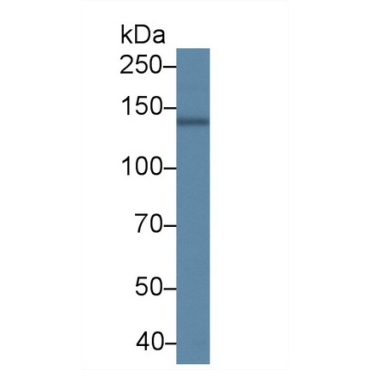 ATPase, Ca++ Transporting, Cardiac Muscle, Slow Twitch 2 (ATP2A2) Human Polyclonal Antibody