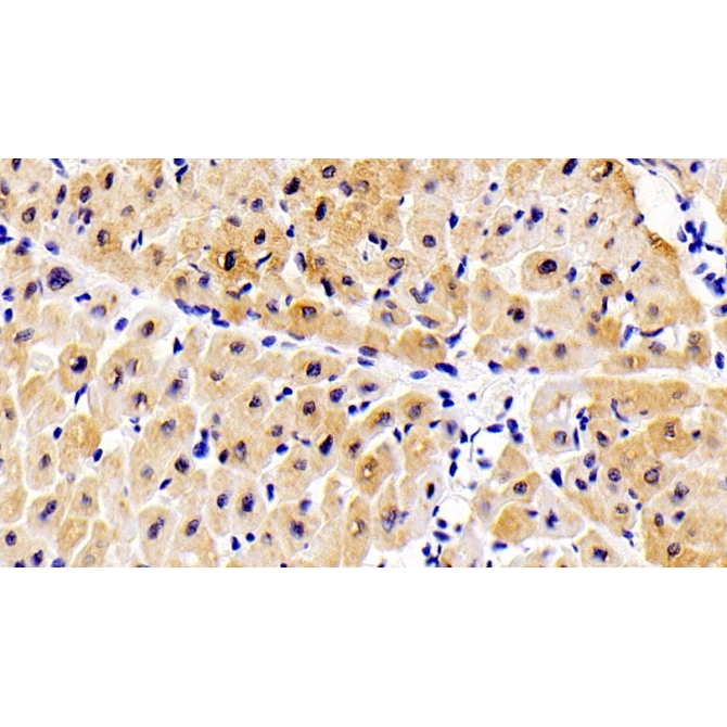 ATPase, Ca++ Transporting, Cardiac Muscle, Slow Twitch 2 (ATP2A2) Human Polyclonal Antibody