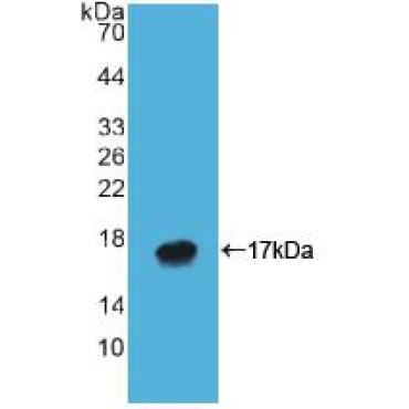 ATPase, H+/K+ Exchanging Alpha Polypeptide (ATP4a) Human Polyclonal Antibody