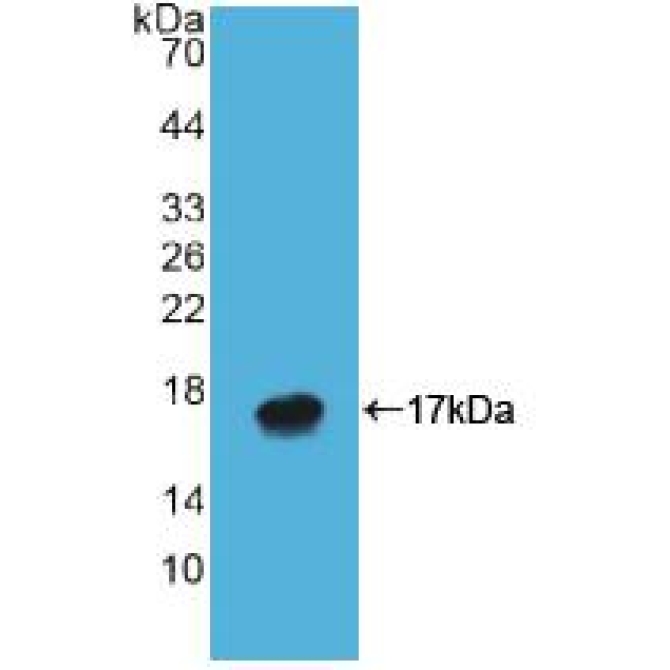 ATPase, H+/K+ Exchanging Alpha Polypeptide (ATP4a) Human Polyclonal Antibody