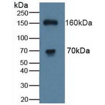 ATPase, Cu++ Transporting Beta Polypeptide (ATP7b) Human Polyclonal Antibody