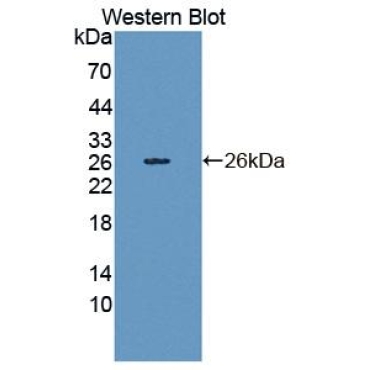 Cadherin 23 (CDH23) Human Polyclonal Antibody