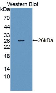 Cadherin 23 (CDH23) Human Polyclonal Antibody