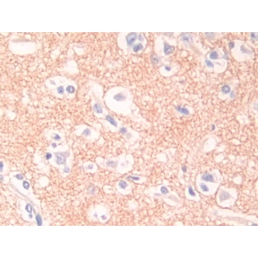 Desmocollin 1 (DSC1) Human Polyclonal Antibody