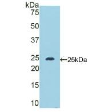 Desmocollin 1 (DSC1) Mouse Polyclonal Antibody