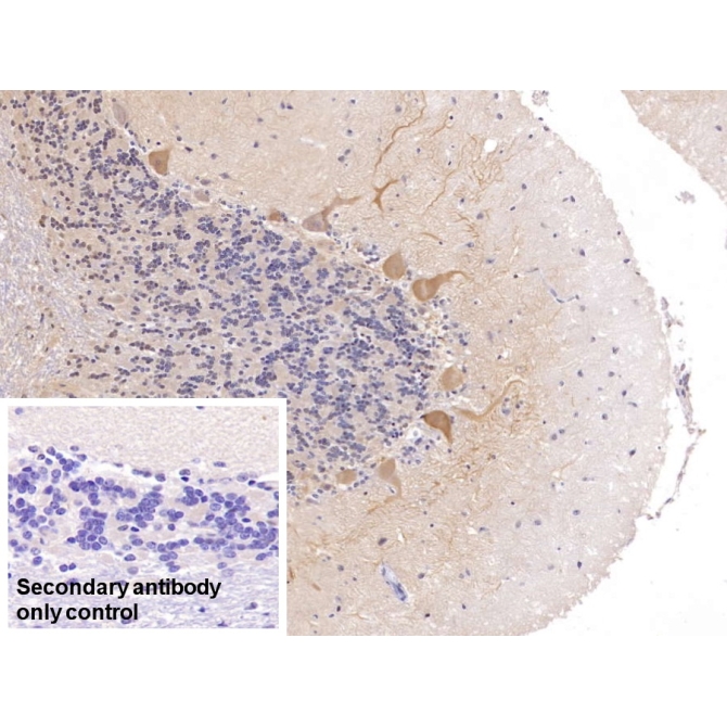 Calbindin (CALB) Human Polyclonal Antibody
