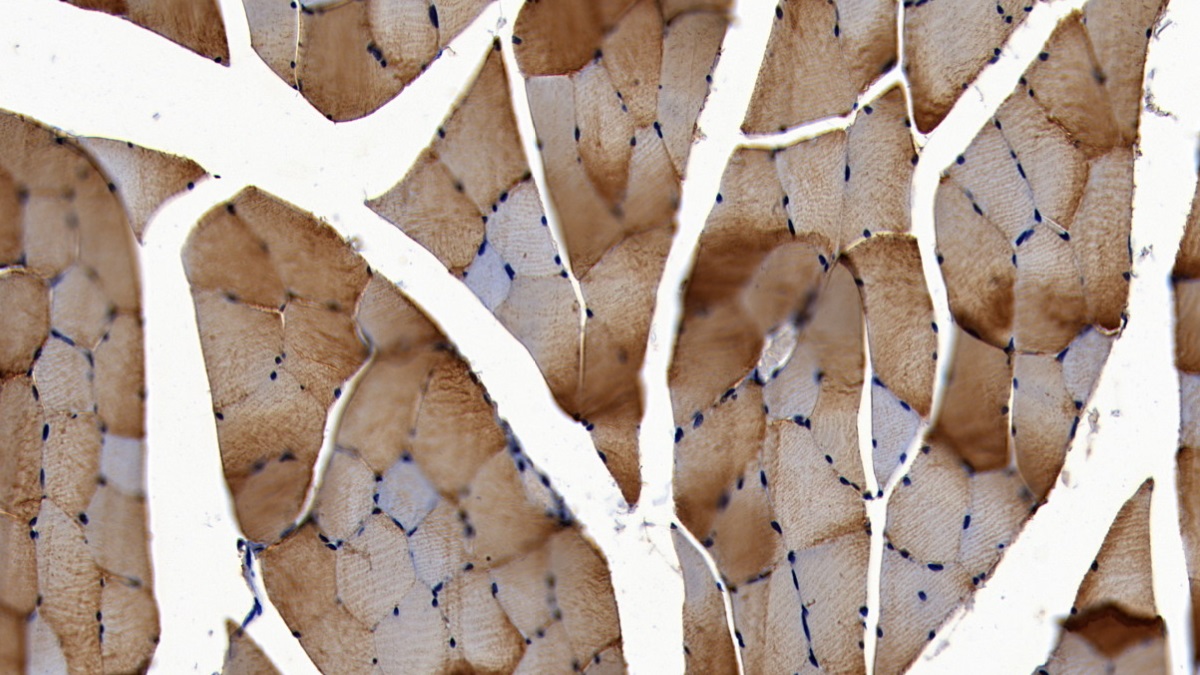 Parvalbumin (PVALB) Rat Polyclonal Antibody