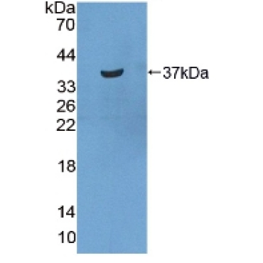 Statherin (STATH) Human Polyclonal Antibody