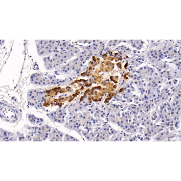 5-Methyltetrahydrofolate Homocysteine Methyltransferase (MTR) Human Polyclonal Antibody