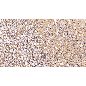 Betaine Homocysteine Methyltransferase 2 (BHMT2) Human Polyclonal Antibody