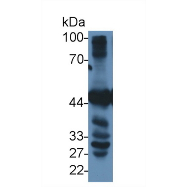 Betaine Homocysteine Methyltransferase (BHMT) Human Polyclonal Antibody