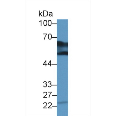 Dopa Decarboxylase (DDC) Human Polyclonal Antibody