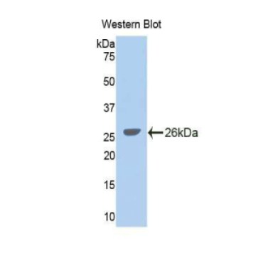 Glycine Dehydrogenase (GLDC) Human Polyclonal Antibody