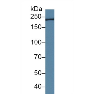 Trichohyalin (TCHH) Human Polyclonal Antibody