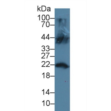 Lipocalin 12 (LCN12) Human Polyclonal Antibody
