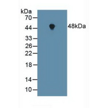 Farnesyltransferase Alpha (FNTa) Human Polyclonal Antibody