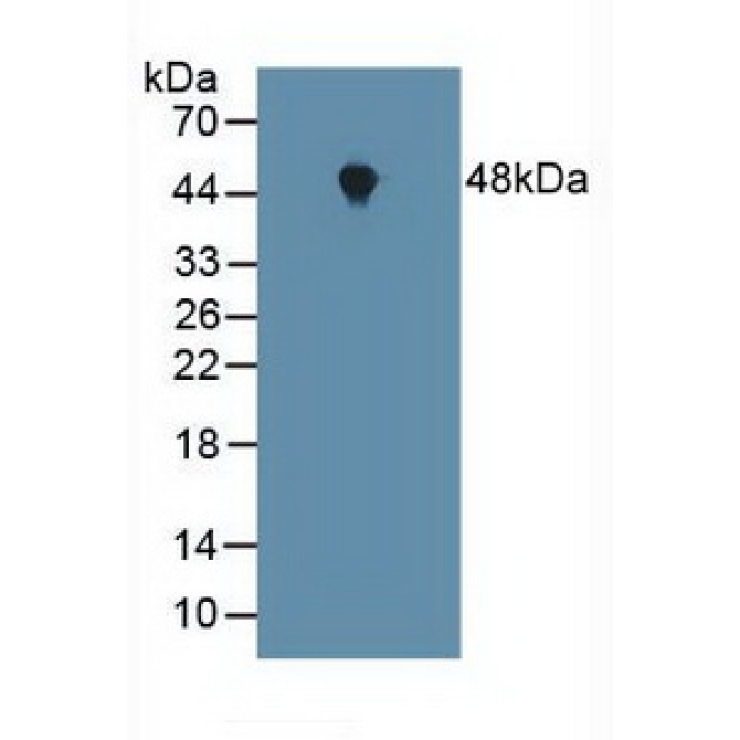 Farnesyltransferase Alpha (FNTa) Human Polyclonal Antibody