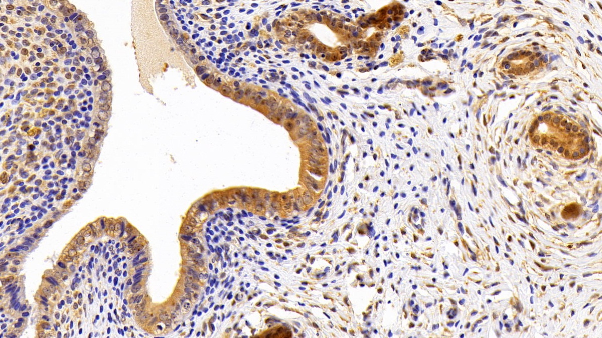 Lipin 1 (LPIN1) Rat Polyclonal Antibody