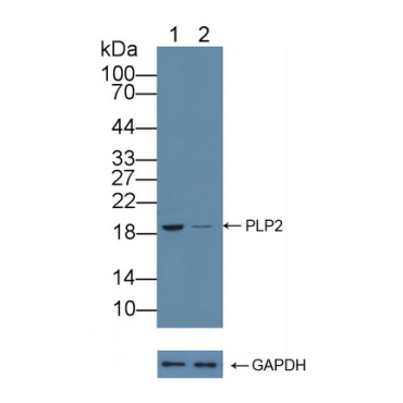 Proteolipid Protein 2, Colonic Epithelium Enriched (PLP2) Human Polyclonal Antibody
