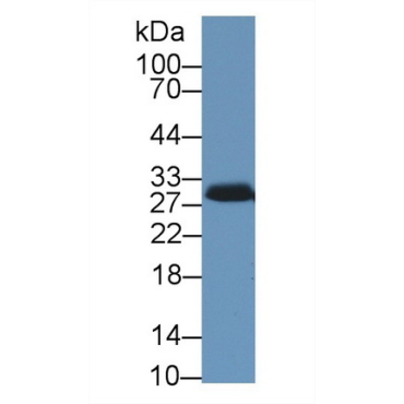 Steroidogenic Acute Regulatory Protein (STAR) Human Polyclonal Antibody