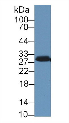 Steroidogenic Acute Regulatory Protein (STAR) Human Polyclonal Antibody