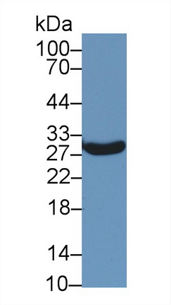 Steroidogenic Acute Regulatory Protein (STAR) Rat Polyclonal Antibody