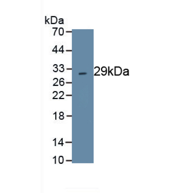 Chymase 1, Mast Cell (CMA1) Human Polyclonal Antibody