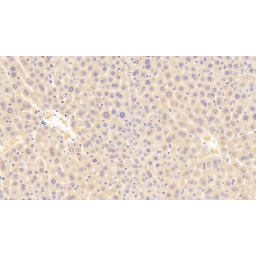 Receptor Tyrosine Kinase Like Orphan Receptor 1 (ROR1) Mouse Polyclonal Antibody