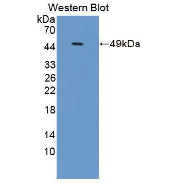 Lysophosphatidylcholine Acyltransferase 1 (LPCAT1) Human Polyclonal Antibody