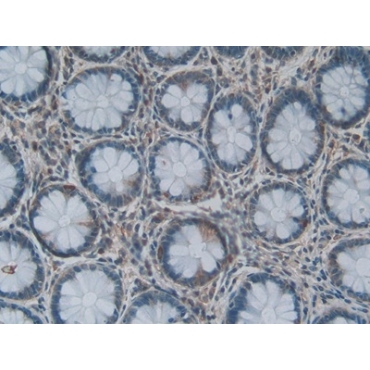 Lysophosphatidylcholine Acyltransferase 3 (LPCAT3) Human Polyclonal Antibody