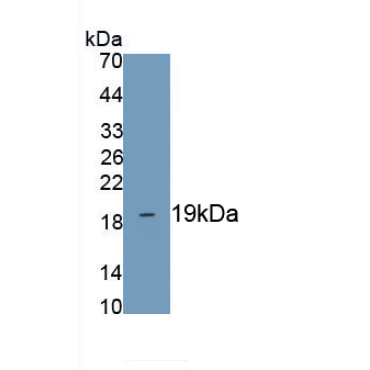 Lysophosphatidylcholine Acyltransferase 3 (LPCAT3) Mouse Polyclonal Antibody