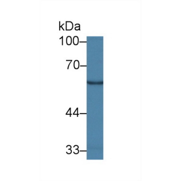 Galactosylceramidase (GALC) Human Polyclonal Antibody