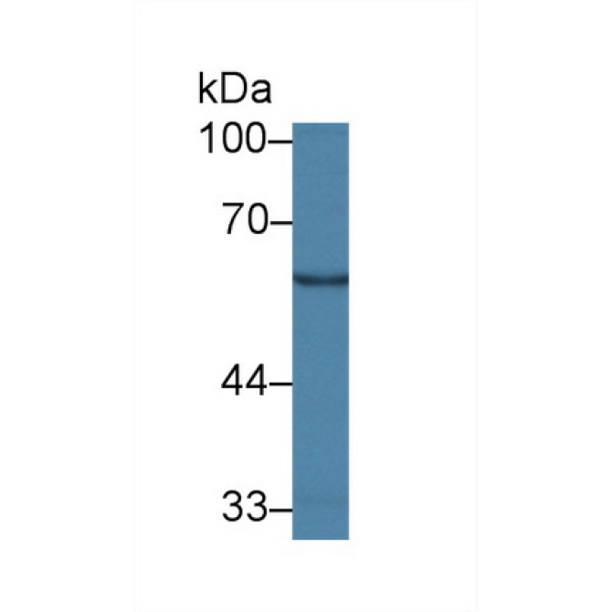 Galactosylceramidase (GALC) Human Polyclonal Antibody