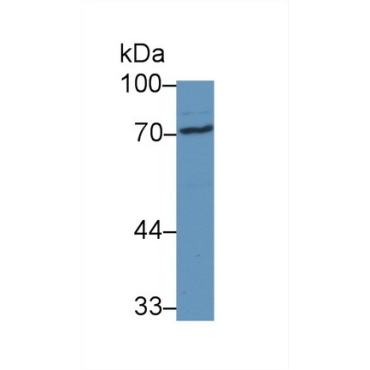 Steroid Sulfatase Isozyme S (STS) Human Polyclonal Antibody