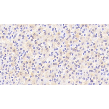 Arylsulfatase F (ARSF) Human Polyclonal Antibody