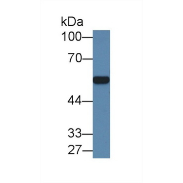 Arylsulfatase A (ARSA) Human Polyclonal Antibody